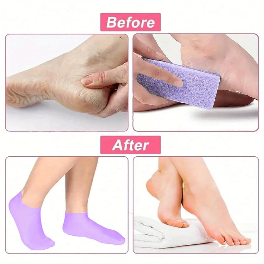 Moisturizing Silicone Foot Socks – Repair Dry & Cracked Feet Overnight